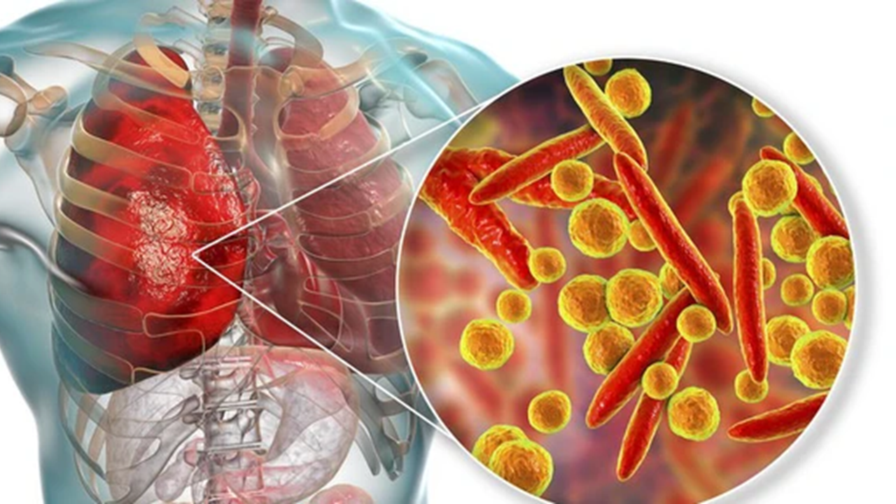 Cholesterol acquires by Mycoplasma pneumoniae: P116 Emerges as a Drug Target—and a Potential “Living” Delivery Platform
